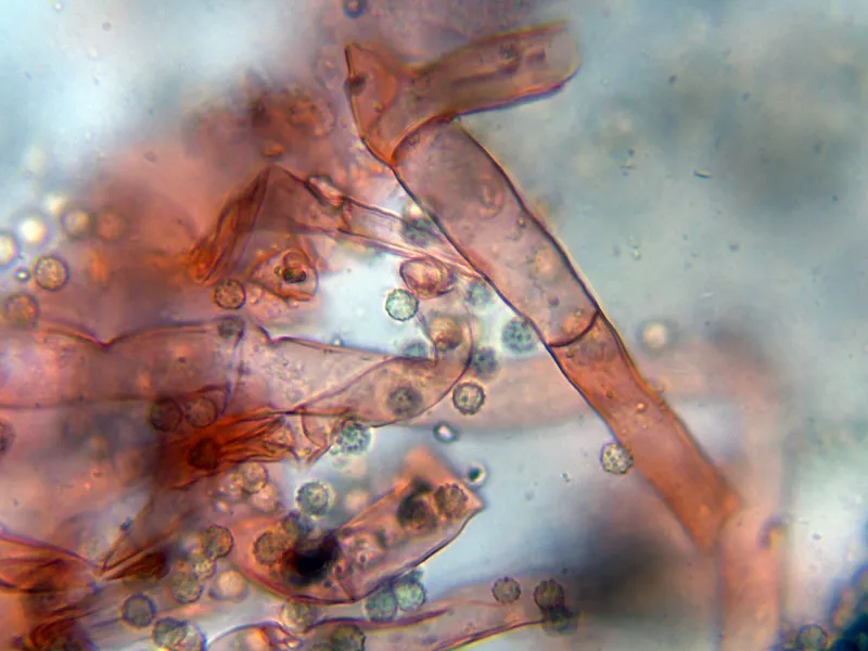 Ostracoderma ochraceum 10 - Hifas-001